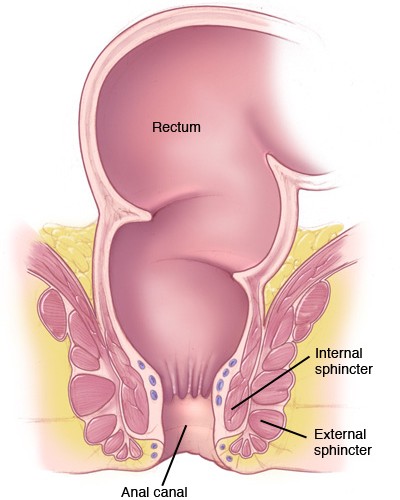Anal Stricture